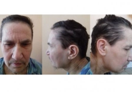 психически больная женщина