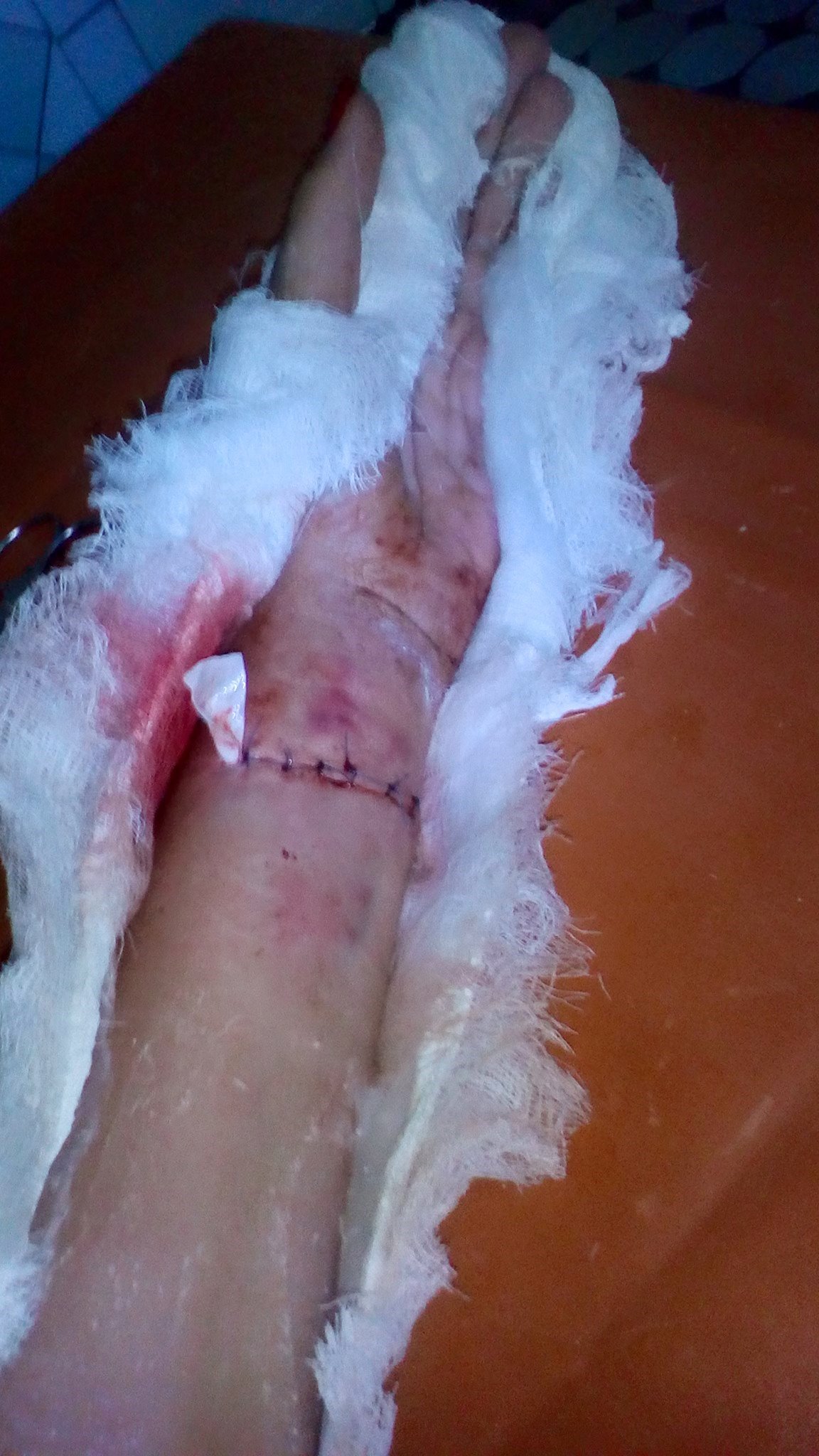 20746422_987354131415912_6086824824371610852_o