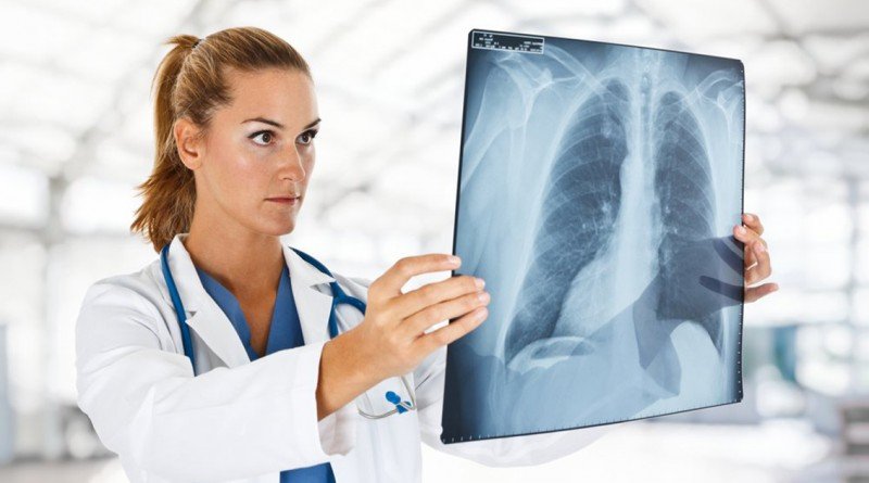 Туберкулез