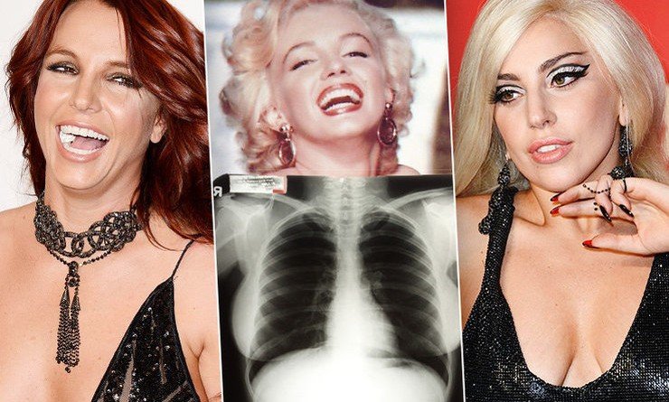 лоты от звезд